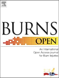 Burns Open