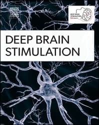 Deep Brain Stimulation