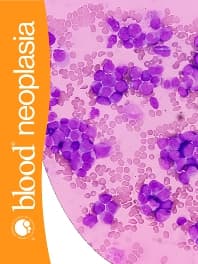 Blood Neoplasia