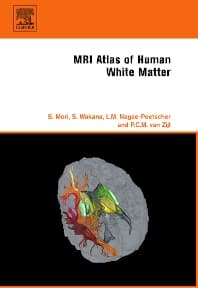 MRI Atlas of Human White Matter