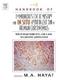 Handbook of Immunohistochemistry and in situ Hybridization of Human Carcinomas