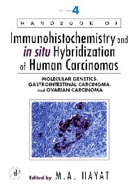 Handbook of Immunohistochemistry and in situ Hybridization of Human Carcinomas