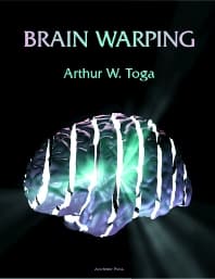 Brain Warping