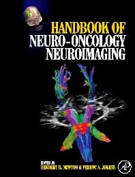 Handbook of Neuro-Oncology Neuroimaging