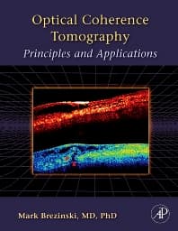 Optical Coherence Tomography