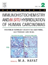 Handbook of Immunohistochemistry and in Situ Hybridization of Human Carcinomas