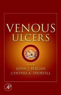 Venous Ulcers