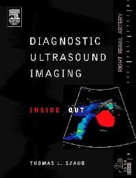 Diagnostic Ultrasound Imaging: Inside Out