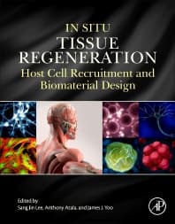 In Situ Tissue Regeneration