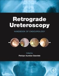 Retrograde Ureteroscopy