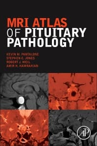 MRI Atlas of Pituitary Pathology