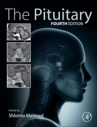 The Pituitary