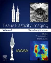 Tissue Elasticity Imaging