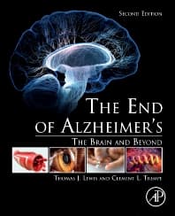 The End of Alzheimer’s