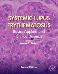 Systemic Lupus Erythematosus