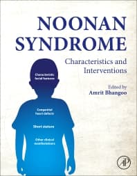 Noonan Syndrome