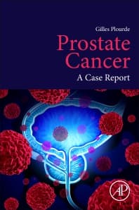 Prostate Cancer