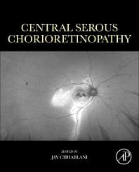 Central Serous Chorioretinopathy