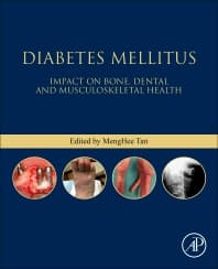 Image - Diabetes Mellitus
