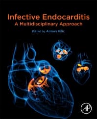 Infective Endocarditis