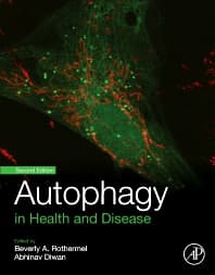 Autophagy in Health and Disease