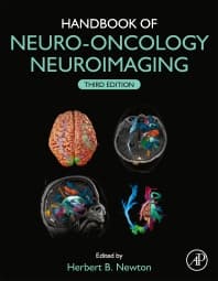 Handbook of Neuro-Oncology Neuroimaging