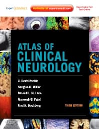 Atlas of Clinical Neurology