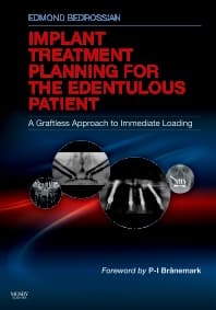 Implant Treatment Planning for the Edentulous Patient