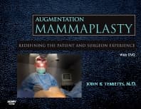 Augmentation Mammaplasty with DVD