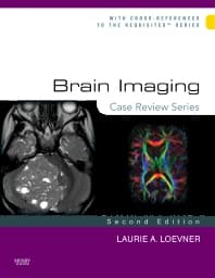 Brain Imaging: Case Review Series