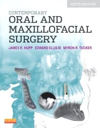 Contemporary Oral and Maxillofacial Surgery