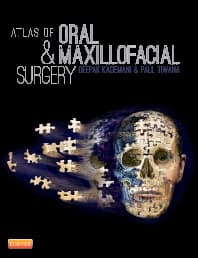 Atlas of Oral and Maxillofacial Surgery