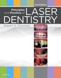 Principles and Practice of Laser Dentistry