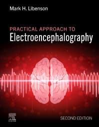 Practical Approach to Electroencephalography