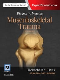 Diagnostic Imaging: Musculoskeletal Trauma