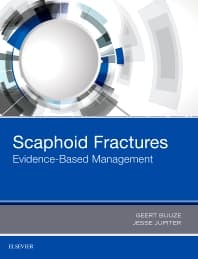 Scaphoid Fractures