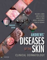 Andrews' Diseases of the Skin