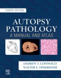 Autopsy Pathology