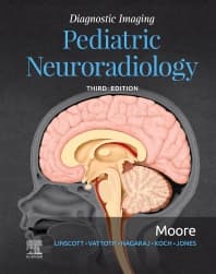 Diagnostic Imaging: Pediatric Neuroradiology