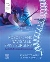 Robotic and Navigated Spine Surgery