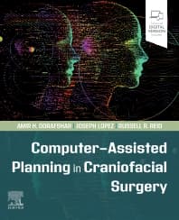 Computer-Assisted Planning in Craniofacial Surgery