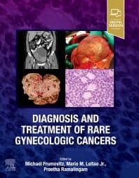 Diagnosis and Treatment of Rare Gynecologic Cancers