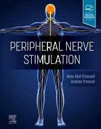 Peripheral Nerve Stimulation