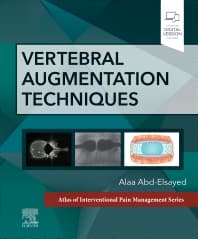 Vertebral Augmentation Techniques