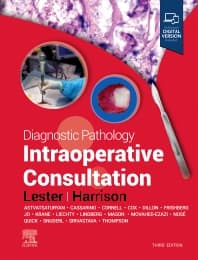 Diagnostic Pathology: Intraoperative Consultation