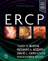 ERCP