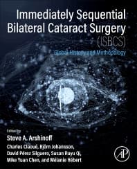 Immediately Sequential Bilateral Cataract Surgery (ISBCS)