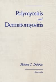 Polymyositis and Dermatomyositis