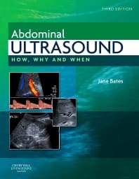 Abdominal Ultrasound