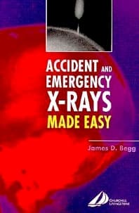 Accident and Emergency X-rays Made Easy, International Edition